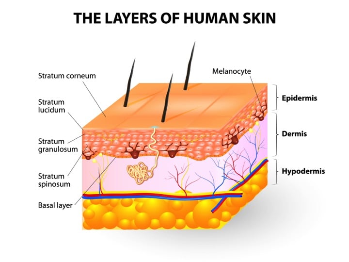 Dermabrasion background, purpose and how it works MedTravel Asia