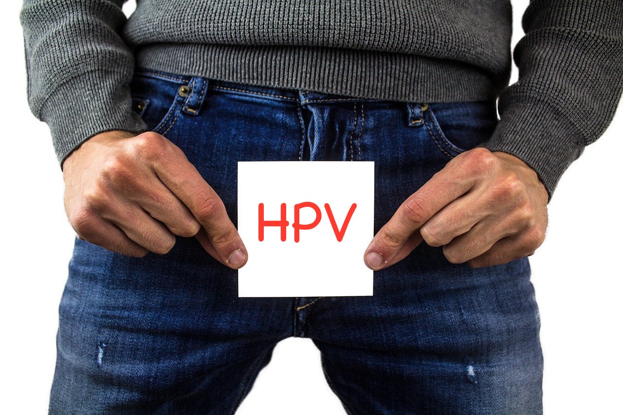 condilomi o verruche genitali causate dal papillomavirus umano HPV