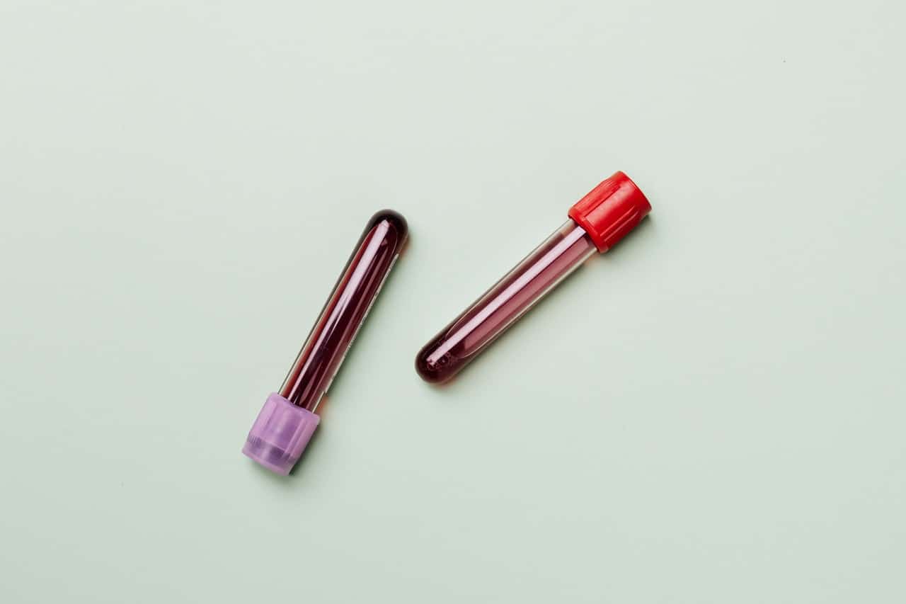 high blood test result
